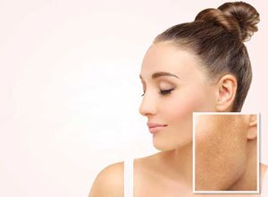 Sparsh Skin and Allergy Clinic in Mathura , Skin treatment in mathura, Skin clinic in  mathura, laser treatment in mathura, Hair treatment in mathura, Best skin clinic in  mathura